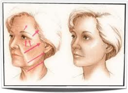En quoi consiste le lifting du visage en 3D ?